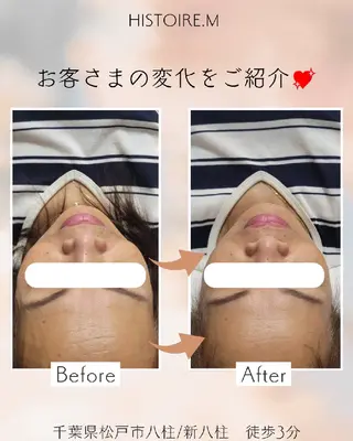 HISTOIRE.M イストアールエム所属・ダイエット/体質改善 /筋膜リリース専門店のエステ・リラクイメージ