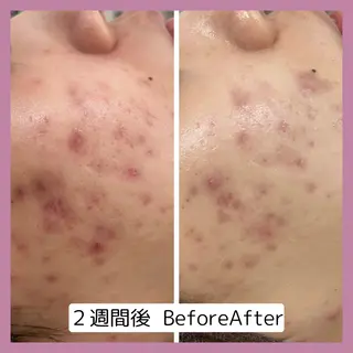 【現役看護師】高来 笑子のエステ・リラクイメージ