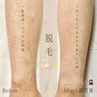 ショート 眉毛専門サロン 【muni】福島野田の眉毛・アイブロウイメージ