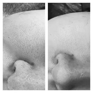 四つ星サロン🎖 腸＆ニキビケアに特化のエステ・リラクイメージ