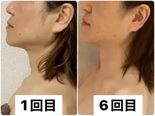 private salon.ohana所属・小顔/ララピール ohanaのエステ・リラクイメージ