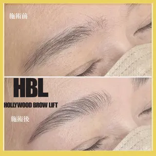 アイブロウ epismoo 脱毛/HBL/毛穴の眉毛・アイブロウイメージ