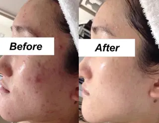 都度払い肌質改善 &脱毛Blancheのエステ・リラクイメージ