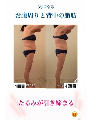 産後ダイエット−9㎏ Pourvous結衣のエステ・リラクイメージ