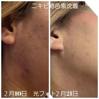 ilima NARUMIのエステ・リラクイメージ