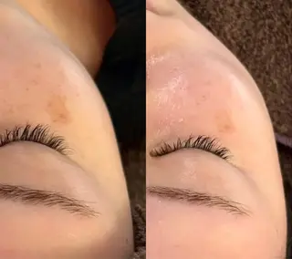 🌼美肌専門 肌質改善🌼のエステ・リラクイメージ