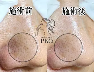 Lipula リプラ所属・毛穴ツヤ肌専門    Lipulaのエステ・リラクイメージ