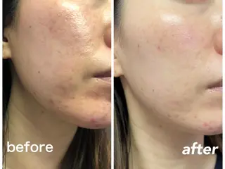 ビューティサロン aiwaのエステ・リラクイメージ