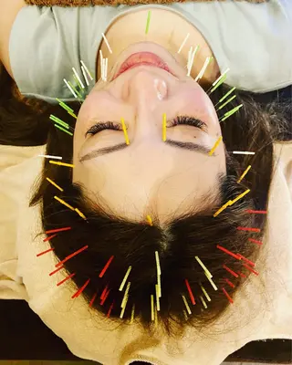 Acupuncture  salon LINOA リノア鍼灸院所属・ヘッドスパ鍼/小顔鍼 耳ツボ 　LINOAのエステ・リラクイメージ