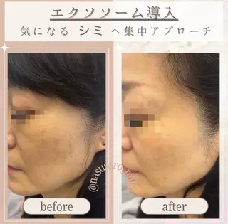 🎀韓国式肌改善🎀 Miku🇰🇷💎のその他イメージ