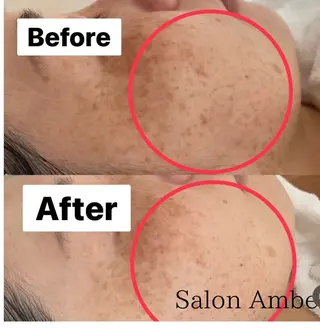 サロン　Ambelle所属・北川 亜友美のエステ・リラクイメージ