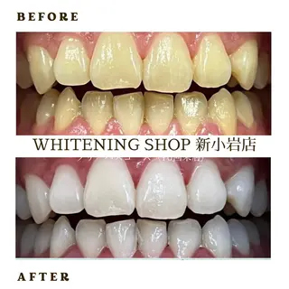 メンズ ホワイトニング ショップ新小岩店のその他イメージ