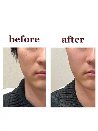 NailBeauty marcherのエステ・リラクイメージ