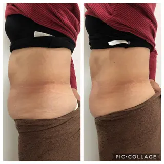 ESPOIR エスポワールのエステ・リラクイメージ