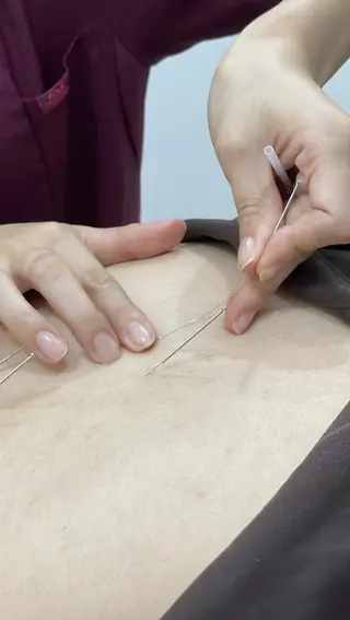 【美容鍼・小顔鍼】 鍼灸師　吉田洋美のその他イメージ