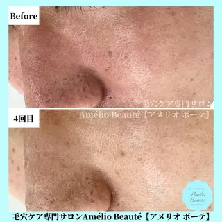 毛穴ケア専門サロン Amélio Beauté所属・毛穴ケア専門サロン アメリオボーテのその他イメージ