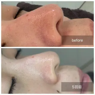 トータルしみケア専門 NICA(ニカ)のエステ・リラクイメージ