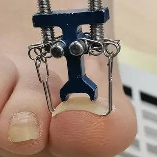 ネイル reve あやののネイルデザイン