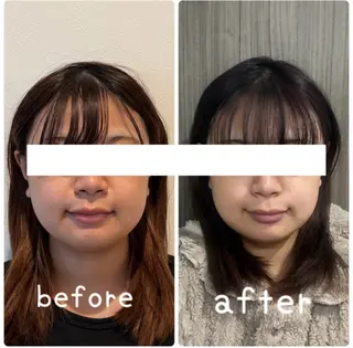 小顔と ヘッドスパのお店のエステ・リラクイメージ