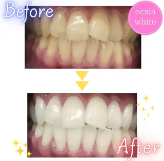 ecxia  white 　広島袋町店所属・セルフホワイトニング エクシア広島袋町店のその他イメージ