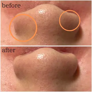 MORE BEAUTY ESTHE 本通り店所属・more 𓍯 のエステ・リラクイメージ