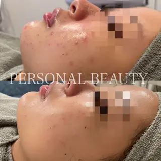 PERSONAL BEAUTY🪻のエステ・リラクイメージ