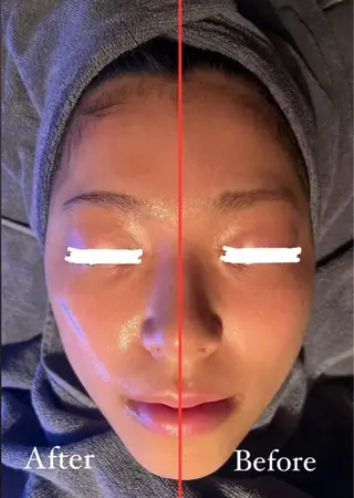 Beauty salon  Liko所属・LIKO フェイシャル&ボディのエステ・リラクイメージ