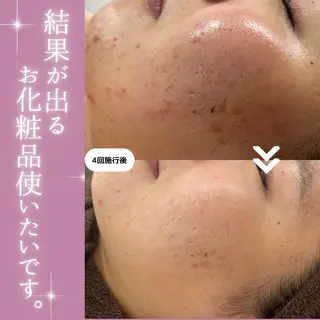 【現役看護師】高来 笑子のエステ・リラクイメージ