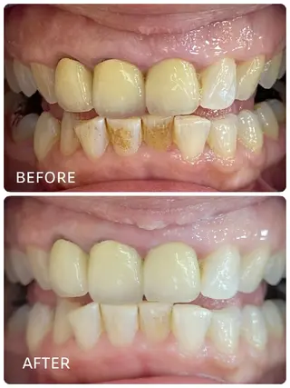 ホワイトニングサロン ラウレアのその他イメージ