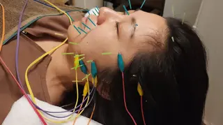 即効⚡小顔美容鍼🪡 むくみたるみ脂肪解消のエステ・リラクイメージ