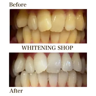 ホワイトニング ショップ川越店のエステ・リラクイメージ