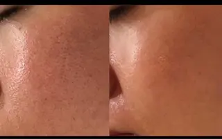 医療提携/ニキビ毛穴 サロンドエクラ南堀江のエステ・リラクイメージ