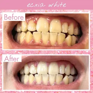 セルフホワイトニング エクシア大府店のその他イメージ