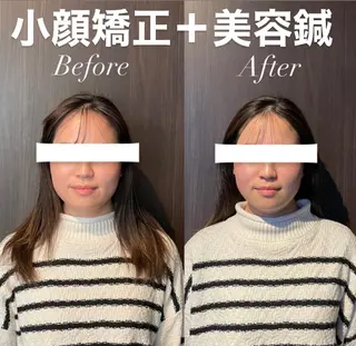 つばさ所属・マッツンの 鍼のその他イメージ