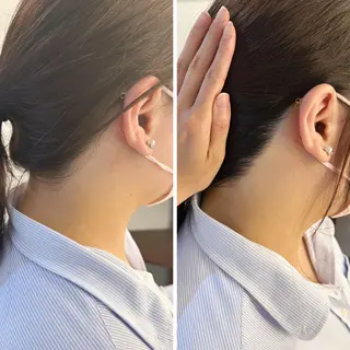 うなじ脱毛/美肌脱毛 LABELのエステ・リラクイメージ