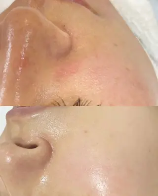 アイブロウ 愛維美水光美肌専門店所属・愛維美水光美肌専門店 メンズレディースokのエステ・リラクイメージ