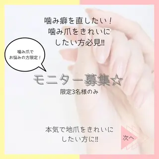 ネイル ステラ marikominoのネイルデザイン