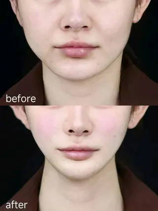 マツエク・マツパ aliaハイフ&水光ジェットサロン所属・aliaハーブ水光店 エステティシャン募集のエステ・リラクイメージ