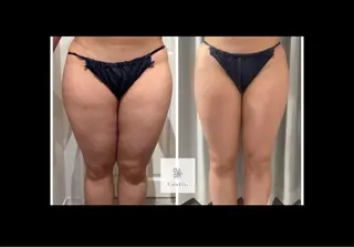 Micell beauty所属・Micell beautyのエステ・リラクイメージ