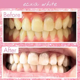 セルフホワイトニング エクシア泉中央店のその他イメージ