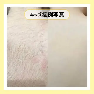 金山/脱毛/美肌 ULULUのエステ・リラクイメージ