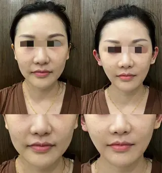 マツエク・マツパ aliaハイフ&水光ジェットサロン所属・aliaハーブ水光店 エステティシャン募集のエステ・リラクイメージ