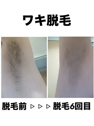 脱毛・眉毛・フェイス サロンN久留米店の眉毛・アイブロウイメージ