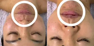 メナード神崎川駅南店所属・吉田 絢香のエステ・リラクイメージ