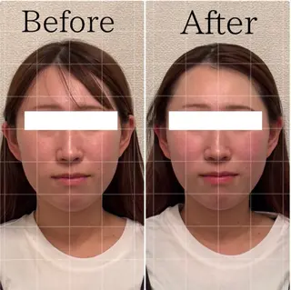 Lily luce 美骨小顔矯正のその他イメージ