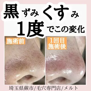 C. Lのマツエク・マツパデザイン