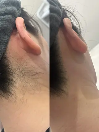 melia 岡山駅前店のエステ・リラクイメージ