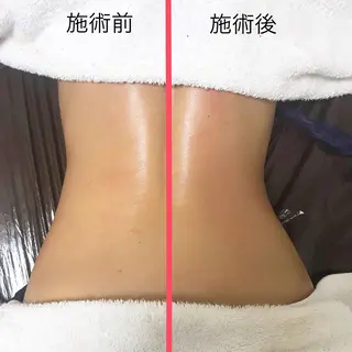 メンズ SORRISO 渋谷のエステ・リラクイメージ