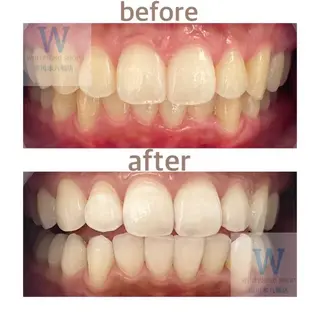 ホワイトニング ショップ本八幡店のエステ・リラクイメージ