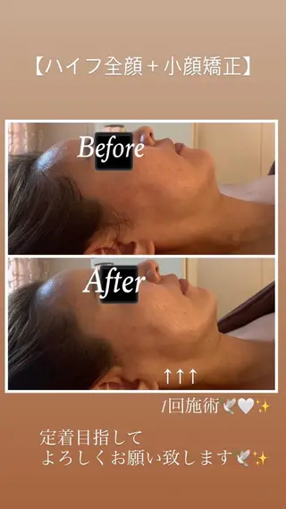 Plaran 〜プララン 〜のその他イメージ